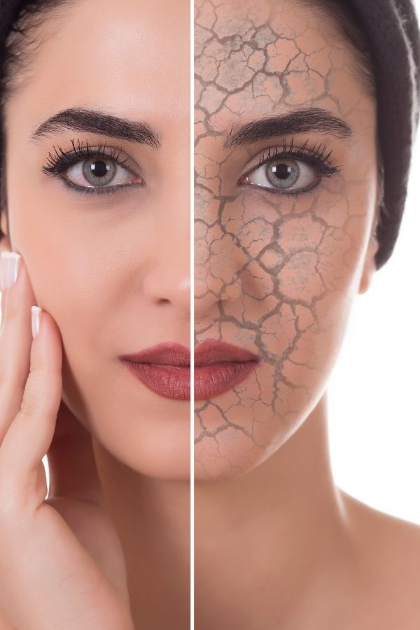 Does my skin get the wintertime blues too?